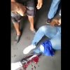 Caracas | Dos mujeres heridas de bala durante enfrentamientos