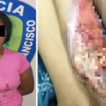 Quemó las manos de su hija por comerse unos alimentos en Zulia