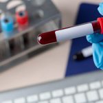Investigadores desarrollan un análisis de sangre para diagnosticar el Alzheimer y medir su grado de progreso